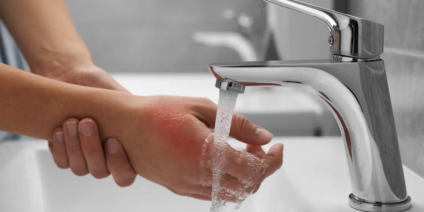 Ferite superficiali: come curarle in maniera efficace 