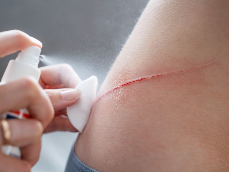 Medicazione e pulizia di un'escoriazione