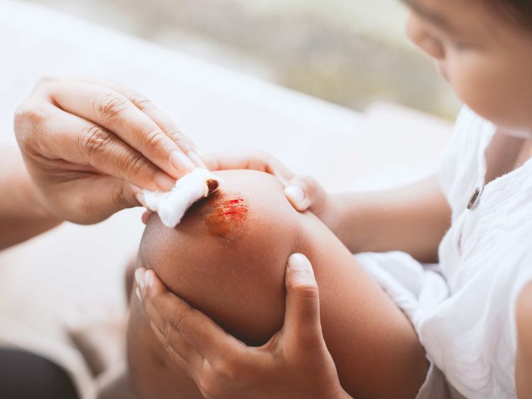 bambina con ferita infetta sul ginocchio